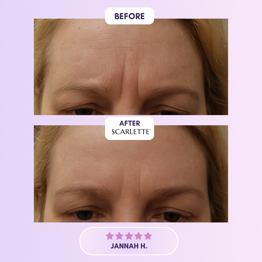 Silicone Collagen Sheets