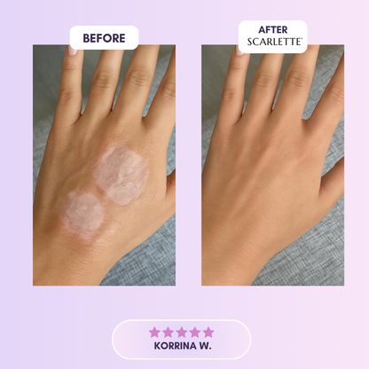 Silicone Collagen Sheets